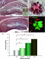 beta Amyloid (1-42) Antibody in Immunohistochemistry (IHC)