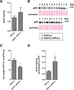 beta Amyloid (1-42) Antibody in Western Blot (WB)