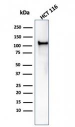 MSH2 Antibody in Western Blot (WB)