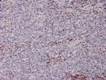 MSH2 Antibody in Immunohistochemistry (Paraffin) (IHC (P))