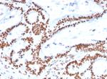 MSH2 Antibody in Immunohistochemistry (Paraffin) (IHC (P))