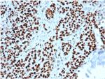 MSH2 Antibody in Immunohistochemistry (Paraffin) (IHC (P))