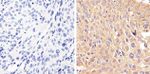 STAT2 Antibody in Immunohistochemistry (Paraffin) (IHC (P))