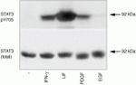 Phospho-STAT3 (Tyr705) Antibody in Western Blot (WB)