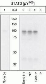 Phospho-STAT3 (Tyr705) Antibody in Western Blot (WB)