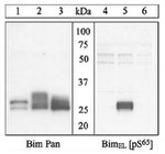 Phospho-Bim (Ser69, Ser65) Antibody in Western Blot (WB)