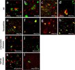 Phospho-IRS1 (Ser312) Antibody in Immunohistochemistry (Paraffin) (IHC (P))