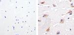 Phospho-SHP2 (Tyr542) Antibody in Immunohistochemistry (Paraffin) (IHC (P))