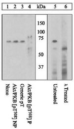 Phospho-AKT1 (Thr308) Antibody in Western Blot (WB)