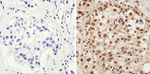 Phospho-AKT1 (Thr308) Antibody in Immunohistochemistry (Paraffin) (IHC (P))