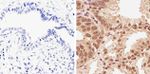 Phospho-AKT1 (Thr308) Antibody in Immunohistochemistry (Paraffin) (IHC (P))