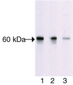 Phospho-AKT1 (Thr308) Antibody in Western Blot (WB)