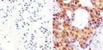 AKT Pan Antibody in Immunohistochemistry (Paraffin) (IHC (P))