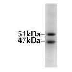 GSK3 alpha/beta Antibody in Western Blot (WB)