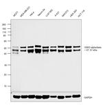 GSK3 alpha/beta Antibody in Western Blot (WB)