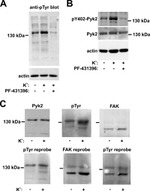 Phospho-PYK2 (Tyr402) Antibody in Western Blot (WB)