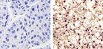 Phospho-PYK2 (Tyr402) Antibody in Immunohistochemistry (Paraffin) (IHC (P))