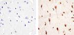 Phospho-PYK2 (Tyr402) Antibody in Immunohistochemistry (Paraffin) (IHC (P))