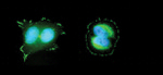 Phospho-FAK (Tyr397) Antibody in Immunocytochemistry (ICC/IF)