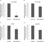 FAK Antibody in Western Blot (WB)