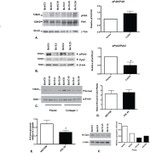 Phospho-PYK2 (Tyr579, Tyr580) Antibody in Western Blot (WB)