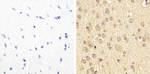 Phospho-PYK2 (Tyr579, Tyr580) Antibody in Immunohistochemistry (Paraffin) (IHC (P))