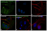 Phospho-SRC (Tyr419) Antibody