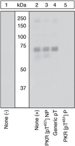 Phospho-PKR (Thr451) Antibody in Western Blot (WB)