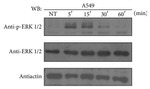 Phospho-ERK1/ERK2 (Thr185, Tyr187) Antibody in Western Blot (WB)