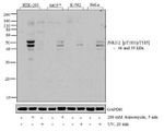 Phospho-JNK1/JNK2 (Thr183, Tyr185) Antibody in Western Blot (WB)