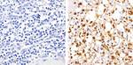 Phospho-NFkB p65 (Ser529) Antibody in Immunohistochemistry (Paraffin) (IHC (P))