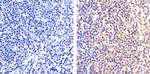 Phospho-NFkB p65 (Ser529) Antibody in Immunohistochemistry (Paraffin) (IHC (P))