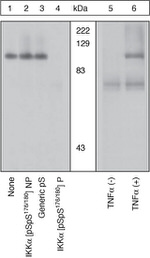 Phospho-IKK alpha (Ser176, Ser180) Antibody in Western Blot (WB)