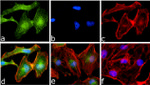 Phospho-IKK alpha (Ser176, Ser180) Antibody in Immunocytochemistry (ICC/IF)