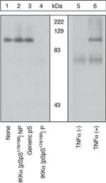 Phospho-IKK alpha (Ser176, Ser180) Antibody