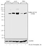 Phospho-Paxillin (Tyr118) Antibody in Western Blot (WB)