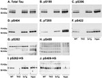 Phospho-Tau (Ser262) Antibody in Western Blot (WB)