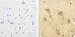 Phospho-Tau (Ser199) Antibody in Immunohistochemistry (Paraffin) (IHC (P))