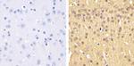 Phospho-Tau (Ser199) Antibody in Immunohistochemistry (Paraffin) (IHC (P))