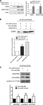 Phospho-Tau (Ser396) Antibody in Western Blot (WB)