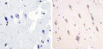 Phospho-Tau (Thr217) Antibody in Immunohistochemistry (Paraffin) (IHC (P))