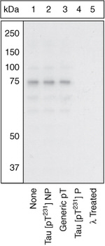 Phospho-Tau (Thr231) Antibody in Western Blot (WB)