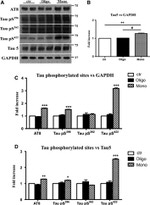 Phospho-Tau (Ser262) Antibody in Western Blot (WB)