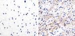 Phospho-Tau (Ser262) Antibody in Immunohistochemistry (Paraffin) (IHC (P))