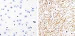 Phospho-Tau (Ser262) Antibody in Immunohistochemistry (Paraffin) (IHC (P))