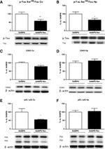 Phospho-Tau (Ser396) Antibody in Western Blot (WB)