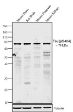 Phospho-Tau (Ser404) Antibody in Western Blot (WB)