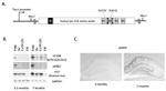 Phospho-Tau (Ser422) Antibody in Immunohistochemistry (IHC)