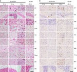 Phospho-Tau (Ser422) Antibody in Immunohistochemistry (Paraffin) (IHC (P))