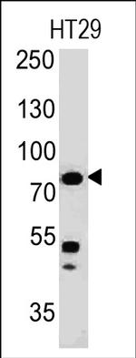 Moesin Antibody in Western Blot (WB)